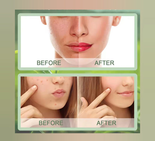 Mascarilla facial Té Verde